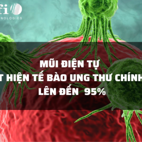 MŨI ĐIỆN TỰ - PHÁT HIỆN TẾ BÀO UNG THƯ CHÍNH XÁC LÊN ĐẾN 95%